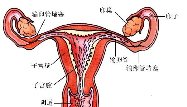濮阳治疗输卵管不孕的方法